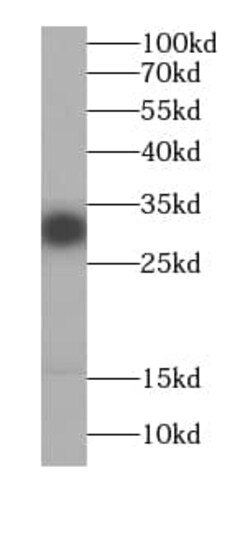 RRP4 Antibody (6E9), Novus Biologicals 100 &mu;g; Unconjugated:Antibodies,