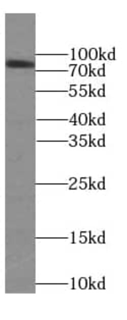 FAF1 Antibody (9H10), Novus Biologicals 100 &mu;g; Unconjugated:Antikörper