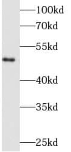 Fibrinogen beta chain Antibody (6F4), Novus Biologicals 100 &mu;g; Unconjugated:Antibodies,