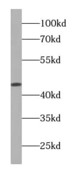FUT9 Antibody (2B6), Novus Biologicals 100 &mu;g; Unconjugated:Antibodies,
