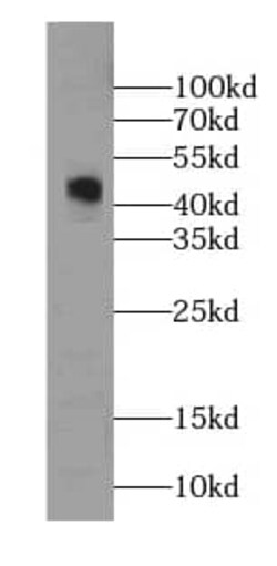 GDI2 Antibody (0B10), Novus Biologicals 100 &mu;g; Unconjugated:Antibodies