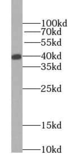alcohol dehydrogenase 5 Antibody (3E7), Novus Biologicals 100 &mu;g; Unconjugated:Anticuerpos