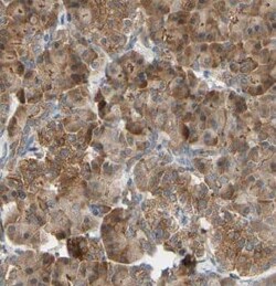 GSTO1 Antibody (9H4), Novus Biologicals 100 &mu;g; Unconjugated:Antibodies,
