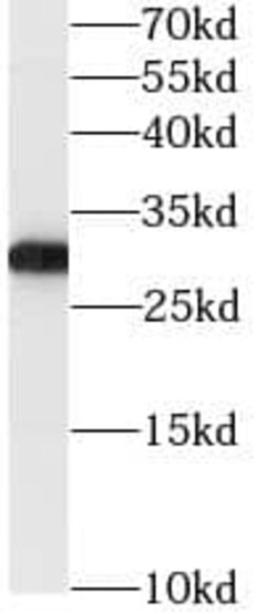 GSTO1 Antibody (9H4), Novus Biologicals 100 &mu;g; Unconjugated:Antibodies,
