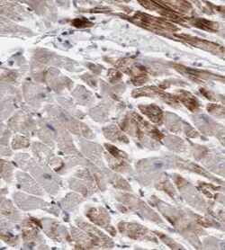 HADHA Antibody (6A0), Novus Biologicals 100 &mu;g; Unconjugated:Antibodies,