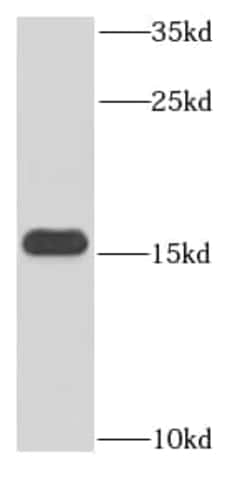 Hemoglobin epsilon Antibody (6G7), Novus Biologicals 100 &mu;g; Unconjugated:Antibodies,