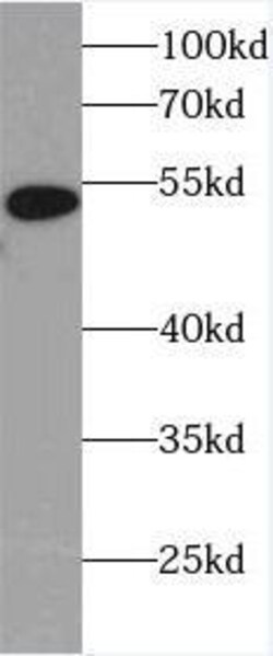 Heparanase/HPSE Antibody (0C0), Novus Biologicals 100 &mu;g; Unconjugated:Antibodies,