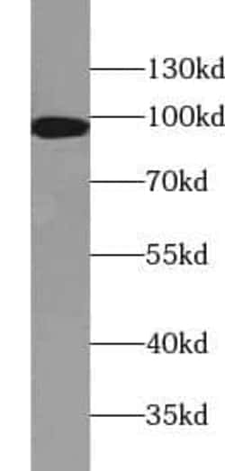 IFT88 Antibody (2B2), Novus Biologicals 100 &mu;g; Unconjugated:Antibodies,