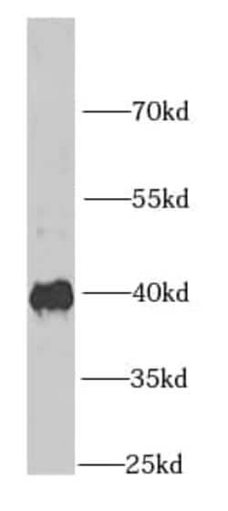 IGBP1 Antibody (6E3), Novus Biologicals 100 &mu;g; Unconjugated:Antibodies,