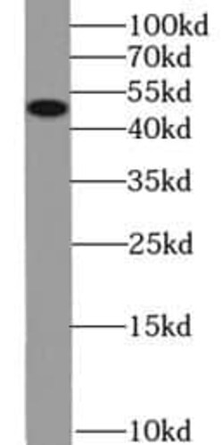 KCNN4 Antibody (8A11), Novus Biologicals 100 &mu;g; Unconjugated:Antibodies,