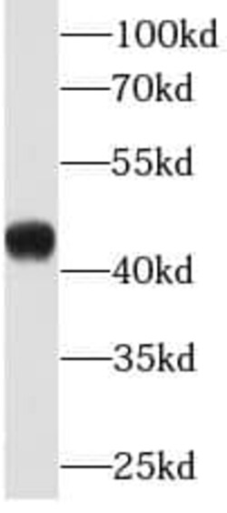 KLF15 Antibody (1C10), Novus Biologicals 100 &mu;g; Unconjugated:Antibodies,
