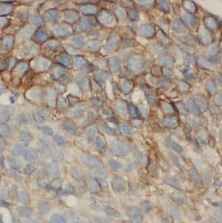 MAGEA3 Antibody (4E9), Novus Biologicals 100 &mu;g; Unconjugated:Antibodies,
