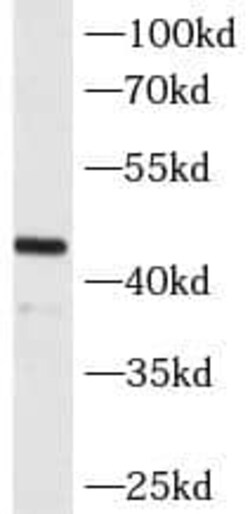 MAGEA3 Antibody (4E9), Novus Biologicals 100 &mu;g; Unconjugated:Antibodies,
