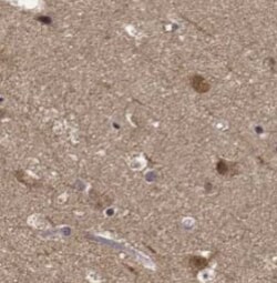 Monoamine Oxidase B Antibody (8E0), Novus Biologicals 100 &mu;g; Unconjugated:Antibodies,