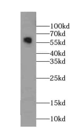 Monoamine Oxidase B Antibody (8E0), Novus Biologicals 100 &mu;g; Unconjugated:Antibodies,