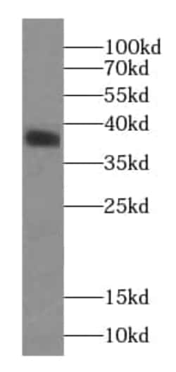 MAP3K12 binding inhibitory protein 1 Antibody (8G3), Novus Biologicals