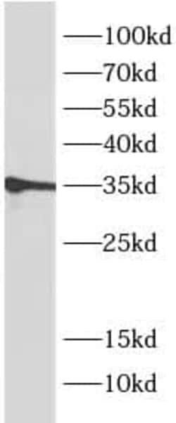 MEST Antibody (5E0), Novus Biologicals 100 &mu;g; Unconjugated:Antibodies,