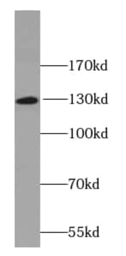 O-GlcNAcase/OGA/MGEA5 Antibody (9B9), Novus Biologicals 100 &mu;g; Unconjugated:Antibodies,