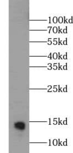 MGP Antibody (8C3), Novus Biologicals 100 &mu;g; Unconjugated:Antibodies,