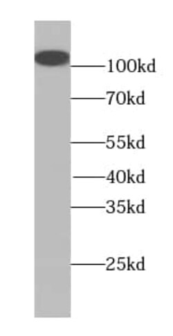 MMS19 like protein Antibody (6H1), Novus Biologicals 100 &mu;g; Unconjugated:Antibodies,