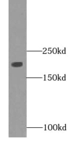 Myosin heavy chain 2 Antibody (4G9), Novus Biologicals 100 &mu;g; Unconjugated:Antibodies,