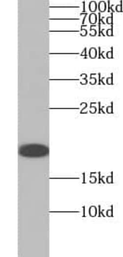 Myosin Light Chain 2 Antibody (1F7), Novus Biologicals 100 &mu;g; Unconjugated:Antibodies,