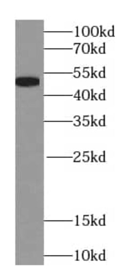 NAPRT1 Antibody (0C6), Novus Biologicals 100 &mu;g; Unconjugated:Anticuerpos