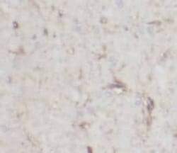 NCALD Antibody (9G5), Novus Biologicals 100 &mu;g; Unconjugated:Antikörper