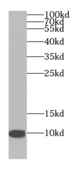NDUFA4L2 Antibody (0B11), Novus Biologicals 100 &mu;g; Unconjugated:Antikörper