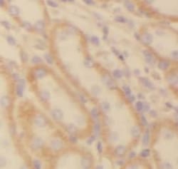 NDUFS5 Antibody (5C2), Novus Biologicals 100 &mu;g; Unconjugated:Antibodies,