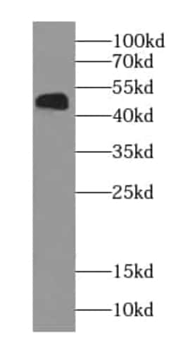 NOB1 Antibody (8G0), Novus Biologicals 100 &mu;g; Unconjugated:Antikörper