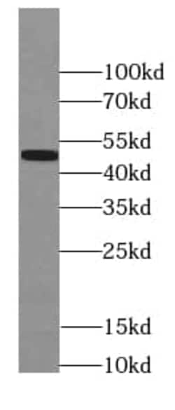 PAX1 Antibody (8D9), Novus Biologicals 100 &mu;g; Unconjugated:Antibodies,