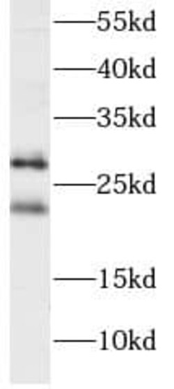PGRMC2 Antibody (0C11), Novus Biologicals 100 &mu;g; Unconjugated:Antibodies,