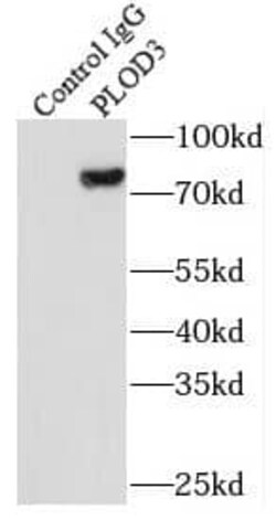 PLOD3 Antibody (2B1), Novus Biologicals 100 &mu;g; Unconjugated:Antibodies,