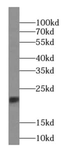 RBBP9 Antibody (7E10), Novus Biologicals 100 &mu;g; Unconjugated:Anticuerpos