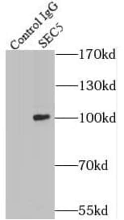 EXOC2 Antibody (0H2), Novus Biologicals 100 &mu;g; Unconjugated:Antibodies,