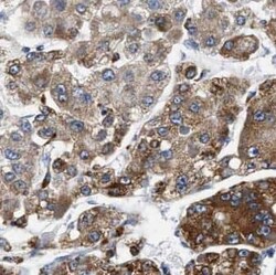 Septin-2 Antibody (8H4), Novus Biologicals 100 &mu;g; Unconjugated:Antikörper