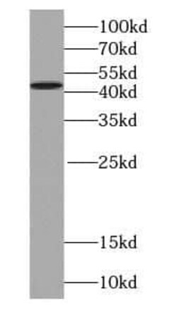 Septin-2 Antibody (8H4), Novus Biologicals 100 &mu;g; Unconjugated:Antikörper