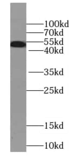 Septin-8 Antibody (9H10), Novus Biologicals 100 &mu;g; Unconjugated:Antibodies,