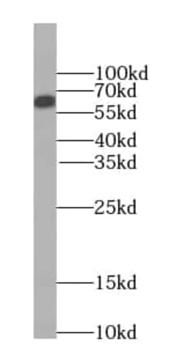 SMARCD1 Antibody (1A7), Novus Biologicals 100 &mu;g; Unconjugated:Antikörper