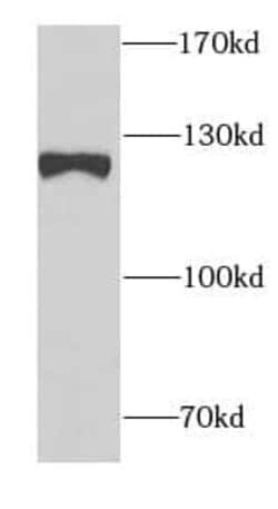 SND1 Antibody (0A1), Novus Biologicals 100 &mu;g; Unconjugated:Antibodies,