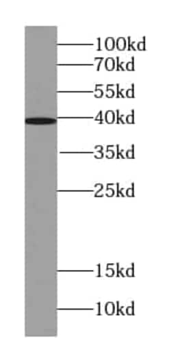ST6 Sialyltransferase 6/ST6GALNAC6 Antibody (1F4), Novus Biologicals 100