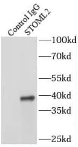 SLP-2 Antibody (5D10), Novus Biologicals 100 &mu;g; Unconjugated:Antibodies,