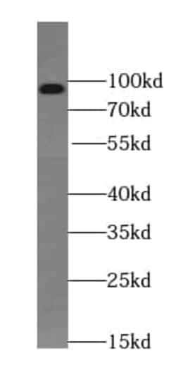 TEL2 Antibody (8B6), Novus Biologicals 100 &mu;g; Unconjugated:Antikörper