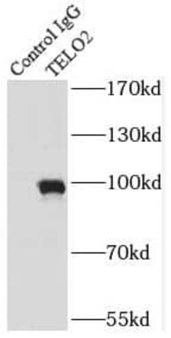TEL2 Antibody (8B6), Novus Biologicals 100 &mu;g; Unconjugated:Antikörper