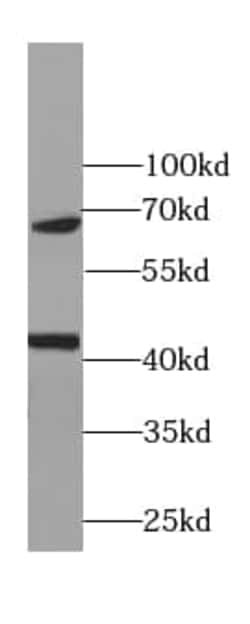RNA polymerase I termination factor Antibody (7C4), Novus Biologicals 100