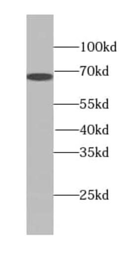Transketolase Antibody (4E2), Novus Biologicals 100 &mu;g; Unconjugated:Antibodies,