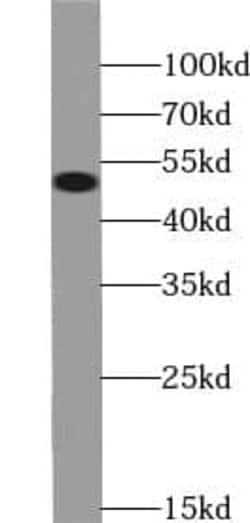 TRIP6 Antibody (2G2), Novus Biologicals 100 &mu;g; Unconjugated:Antibodies,