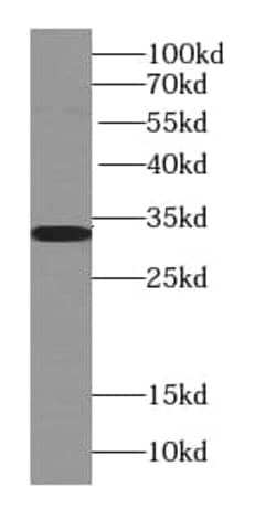 TST Antibody (5E11), Novus Biologicals 100 &mu;g; Unconjugated:Antibodies,