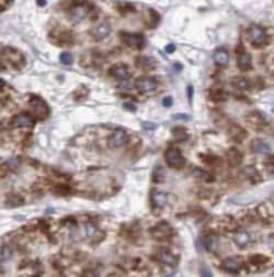 TST Antibody (5E11), Novus Biologicals 100 &mu;g; Unconjugated:Antibodies,